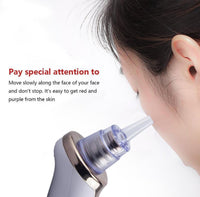 Electric Blackhead Removal & Pore Cleansing Device
