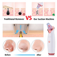 Electric Blackhead Removal & Pore Cleansing Device