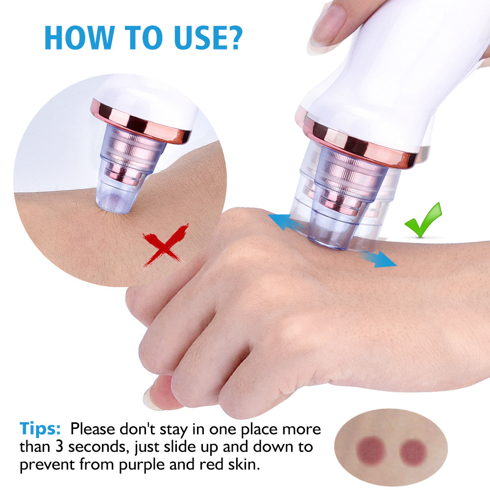 Electric Blackhead Removal & Pore Cleansing Device